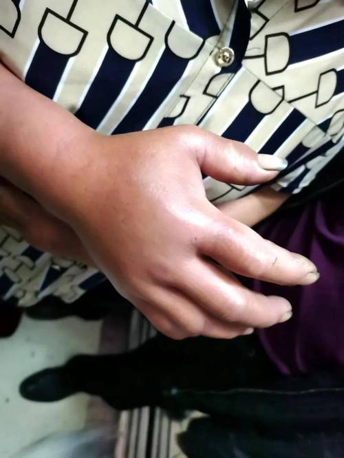 2025澳门开奖结果记录查询和女子遭毒蛇咬伤身亡与女子遭毒蛇咬伤身亡视频